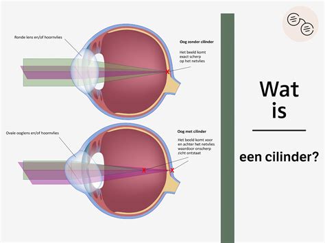 Wat Is Een Cilinder In Je Brilrecept Van Gijzen Opticiens