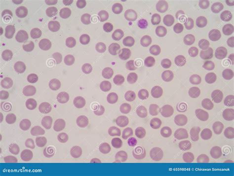 Platelet And White Blood Cells Stock Photo Image Of Hematological