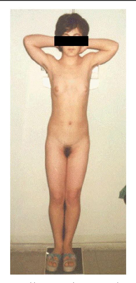 Puberty Naked Telegraph
