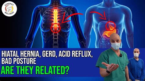 Hiatal Hernia Gerd Acid Reflux And Bad Posture Are They Related