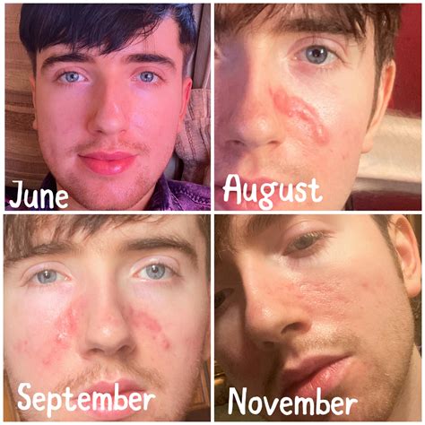 From cysts to scars - it&rsquo;s incredible how quickly your looks can be