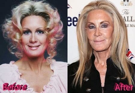 Joan Van Ark Didn T Admit Plastic Surgeries But We Find Some Difference Compare Pictures
