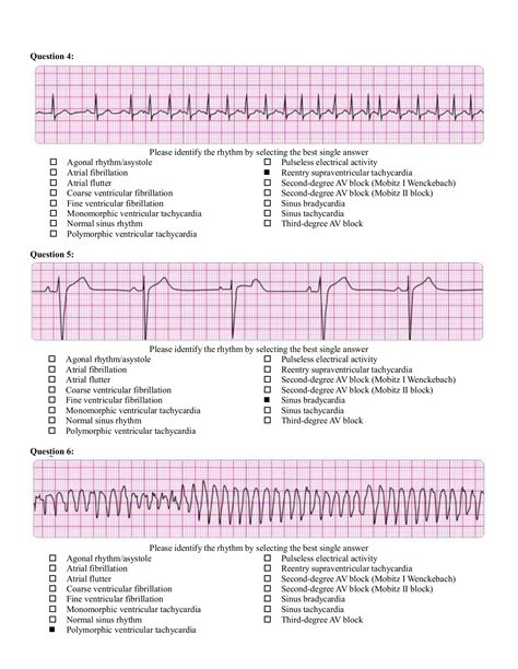 Updated Acls Pretest Rhythm Answers