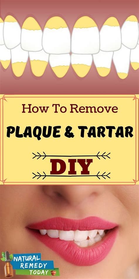Fortunately there are several ways to get rid of plaque on your teeth that are effective enough to maintain your dental plaque looks like a thin and thin layer of yellow or white that generally exists between the teeth flouride protects teeth by binding to the enamel and creating a harder surface. How to Get Rid of Plaque and Tartar - How To Beauty