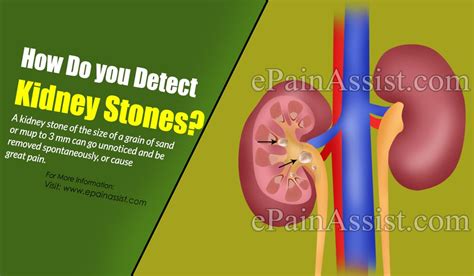 How Can Kidney Stones Be Detected