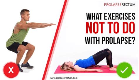 What Exercise Is Best For Prolapse Tutorial Pics