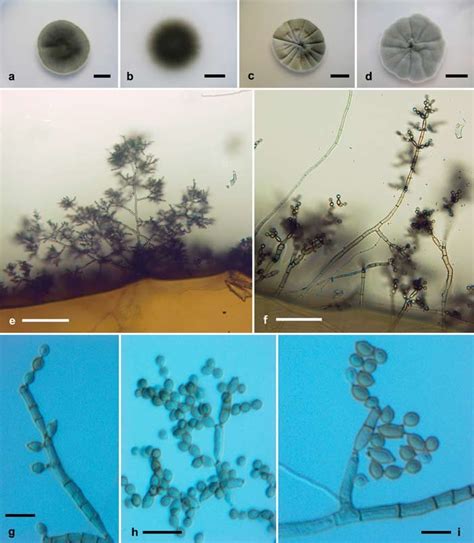Cladosporium Sphaerospermum Macro And Micromorphological Characters