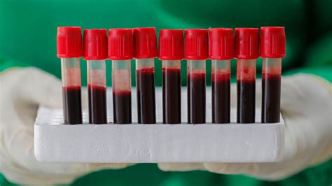 Does Blood Type Affect Your Risk Of Coronavirus Probably Not New
