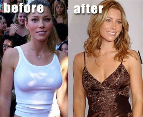 Paulina Gretzky Before And After Jessica Biel Before