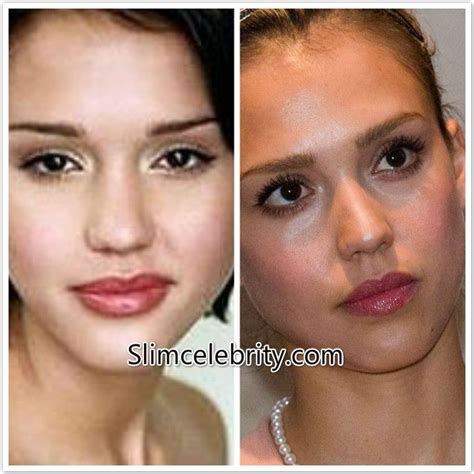 Jessica Alba Plastic Surgery Nose Jobs Before And After Plastic Surgery Celebrity Surgery