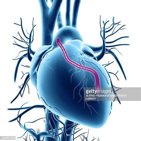 Coronary Artery Bypass Grafting Photos And Premium High Res Pictures