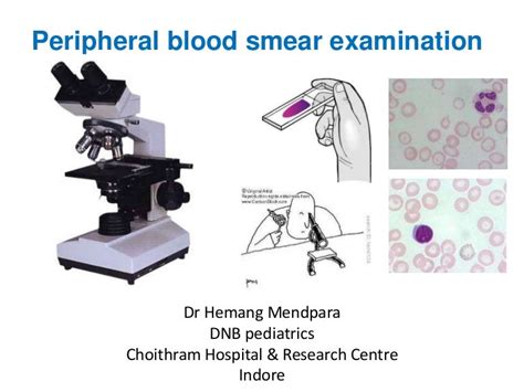 05 Peripheral Blood Smear Examination