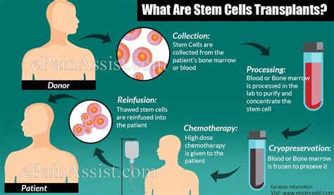 What Are Stem Cells Transplants And How Does It Work