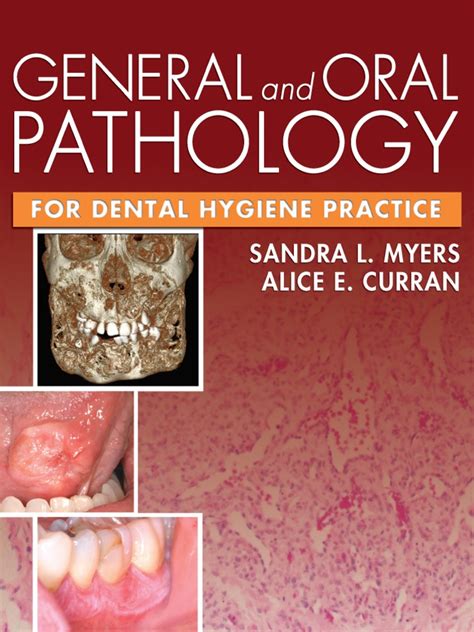 General And Oral Pathology For Dental Hygiene Practice Pathology