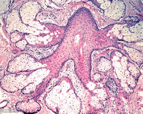Human Skin Sebaceous Glands Stock Photo Download Image Now Biology