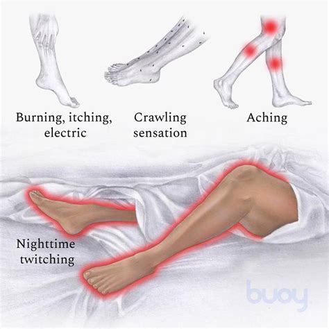 Understanding Restless Legs Syndrome And Its Causes 60 Off