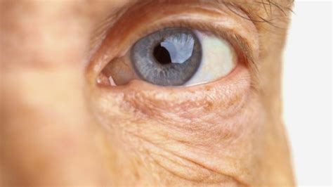 Diabetic Eye Disease Symptoms Causes Treatment And More