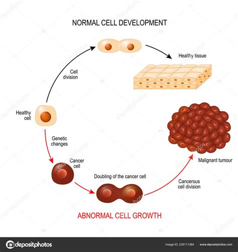 Cancer Cell Normal Cell Healthy Tissue Malignant Tumour Illustration