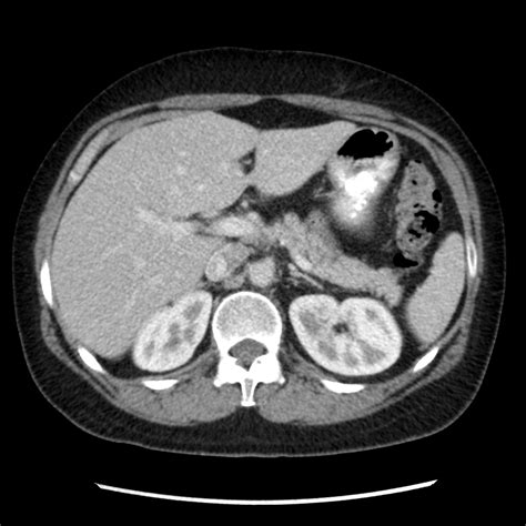 Normal Ct Abdomen Radiology Case