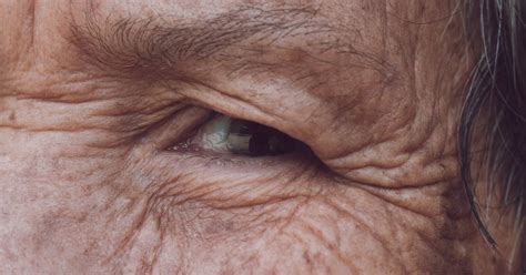 Skin Care For The Elderly Livestrongcom