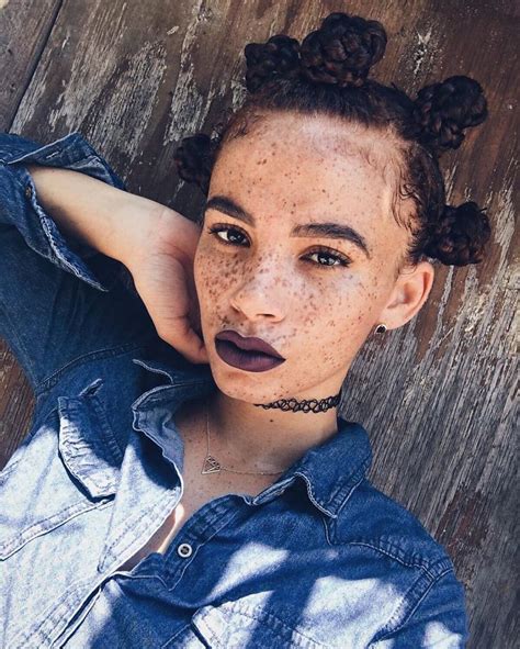 Freckled People Wholl Hypnotize You With Their Unique Beauty