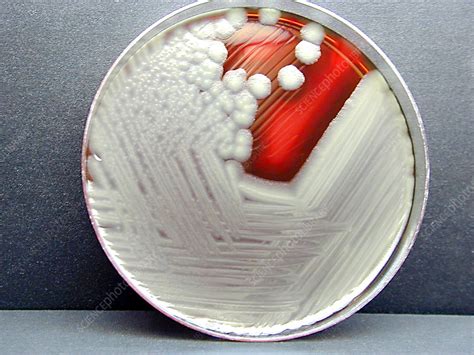 Bacillus Cereus Culture Stock Image B2201608 Science Photo Library