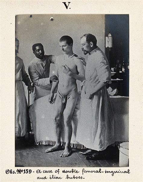 Seamen S Hospital For Infectious Diseases In Jurujuba Rio De Janeiro Naked Male Plague Patient