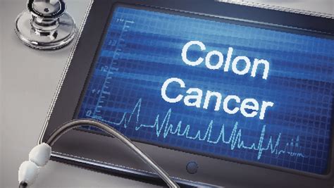 What You Should Know About Colon Cancer Screening