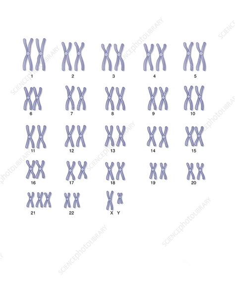 Male Down S Syndrome Karyotype Artwork Stock Image C