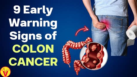9 Signs And Symptoms Of Colon Cancer Colorectal Cancer Warning Signs