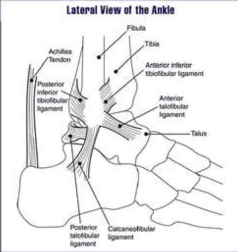 Ankle Pain Lateral Ligament Injury Twisted Or Rolled Ankle