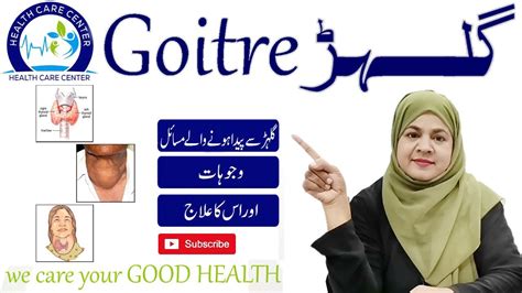 Goitre Treatment گلہڑکاعلاجby Dr Yasmeen Youtube