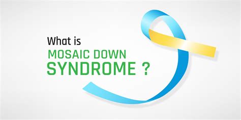 Mosaic Down Syndrome Causes Symptoms Diagnosis And Treatment