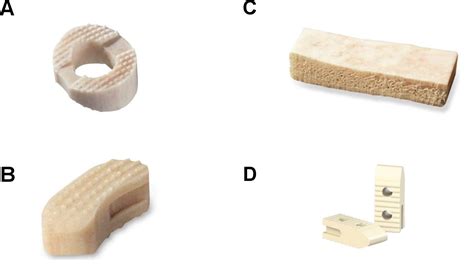 Figure 1 From Comparative Evaluation Of Mineralized Bone Allografts For