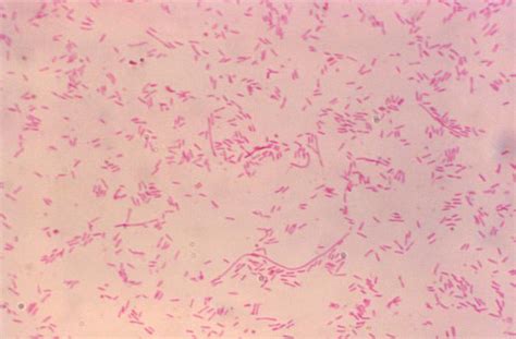Legionella Pneumophila Properties Pathogenesis Lab Diagnosis
