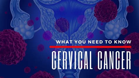 Cervical cancer happens when the cells of your cervix change. Cervical Cancer - What You Need To Know - YouTube