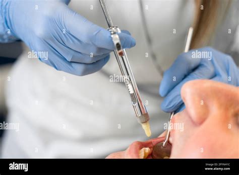 El Dentista Inyecta Jeringa De Anestesia De Los Dientes Enfermos Para