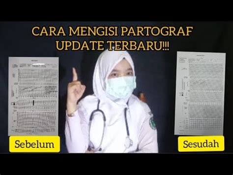 Mamasukkan data ke dalam sel cukup mudah, kita tinggal mengarahkan penunjuk sel/pointer pada sel yang kita inginkan. CARA MENGISI LEMBAR PARTOGRAF TERBARU!!! #fac1 - YouTube