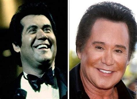 Wayne Newton Before And After - http://www.celeb-surgery ...