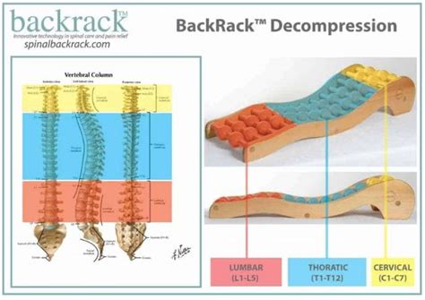 Employees Suffer From Back Pain Archives Spinal Backrack