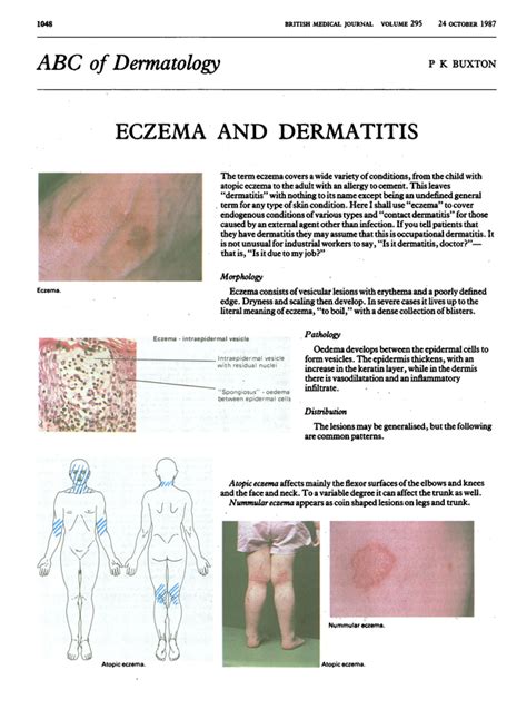 Abc Of Dermatology Eczema And Dermatitis The Bmj
