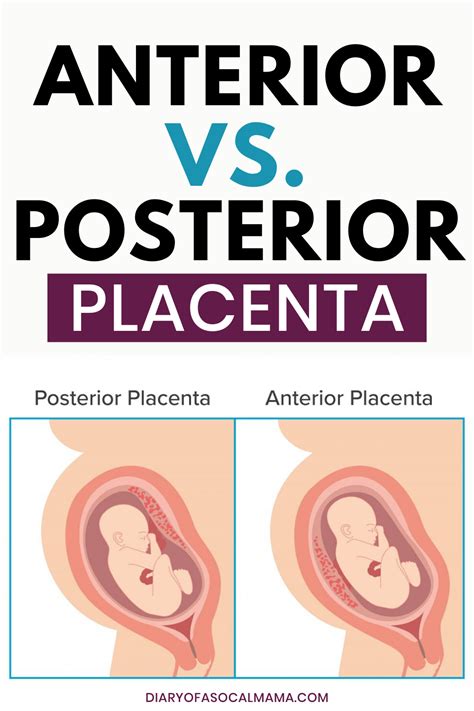 Posterior Placenta Means Boy Or Girl