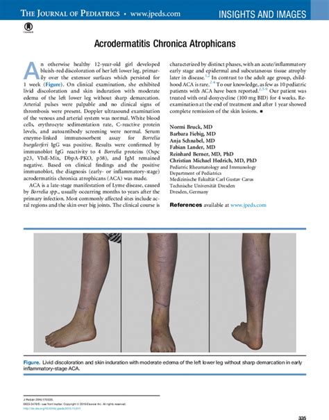 Acrodermatitis Chronica Atrophicans The Journal Of Pediatrics