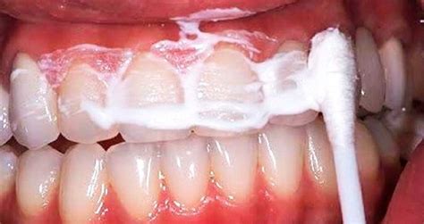 get rid of bad breath tartar and plaque in the mouth with this simple method mindwaft