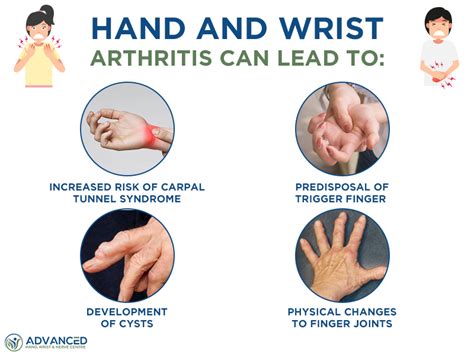 Therapy For Rheumatoid Arthritis In The Hand 60 Off