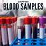 Shipping Blood Samples The Import Regulations You Need To Know