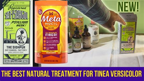 The Best Natural Treatment For Tinea Versicolor Skin Fungus Using
