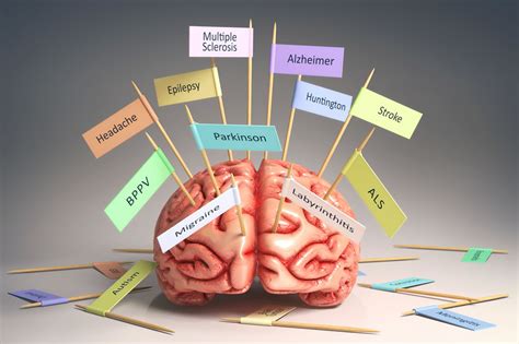 The damaged cells are the ones needed to produce the neurotransmitter called dopamine. WHO officially recognises Stroke as a brain disease