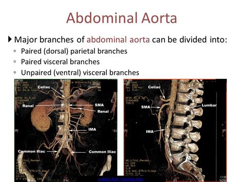 Aorta And Ivc