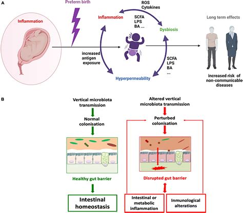 Frontiers Preterm Delivery Microbial Dysbiosis Gut Inflammation And